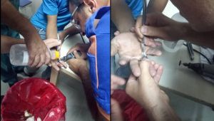 16 yaşındaki gence AFAD'dan yüzük operasyonu