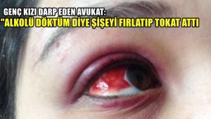 Genç kızı darp eden avukat: