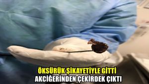 Öksürük şikayetiyle gitti, akciğerinden çekirdek çıktı