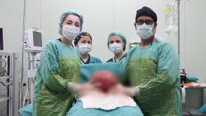 Karabük'te 47 yaşındaki kadından 3 kilo 750 gram ur alındı