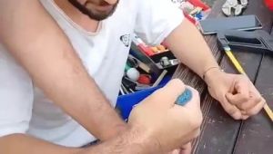 Parmağına sıkışan yüzük spiral makinesi ile kesilerek çıkarıldı