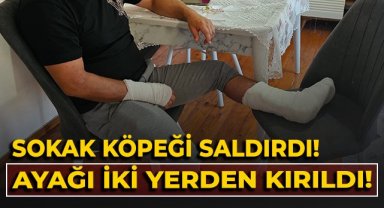 Sokak köpeği saldırdı! Ayağı iki yerden kırıldı